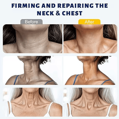 ✨Lumessacare™ Instant Neck Lift Cream  — 🧴 Infused with Retinol & Hyaluronic Acid | Firms the Neck, Reduces Wrinkles & Double Chin